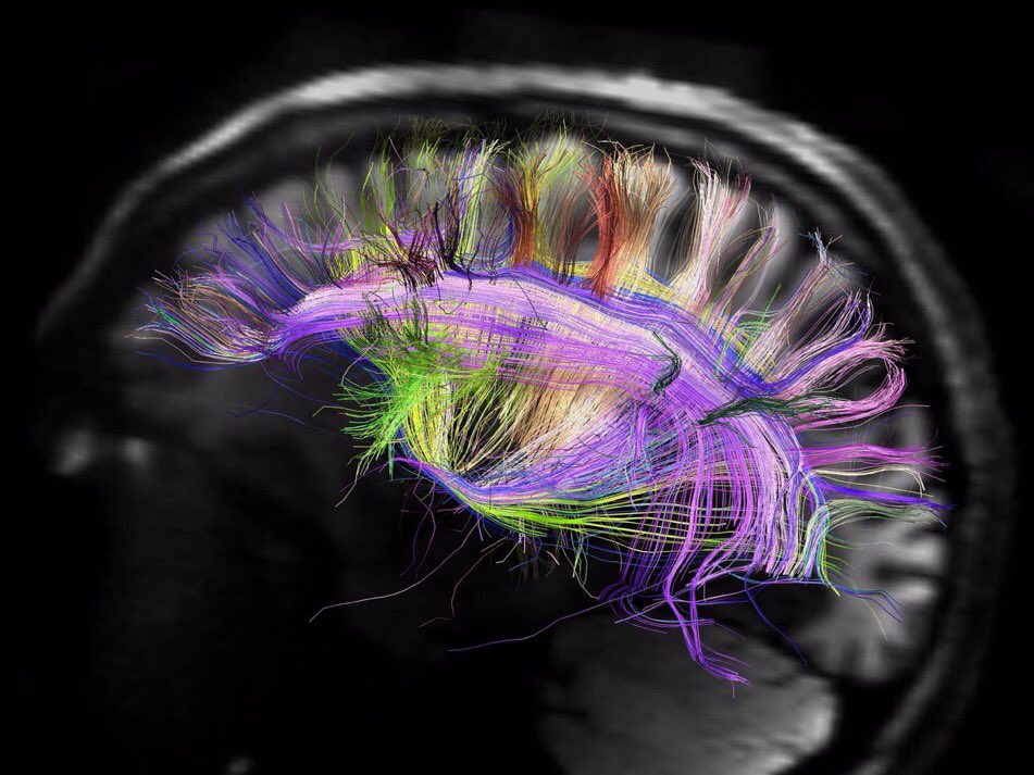 Shi4Tech's tweet photo. Neuroscientists may have figured out exactly how working out reduces stress https://t.co/DPC1r61jWd h/t @MBalaneasa @SherryNothingam https://t.co/A9qq7sLLfh