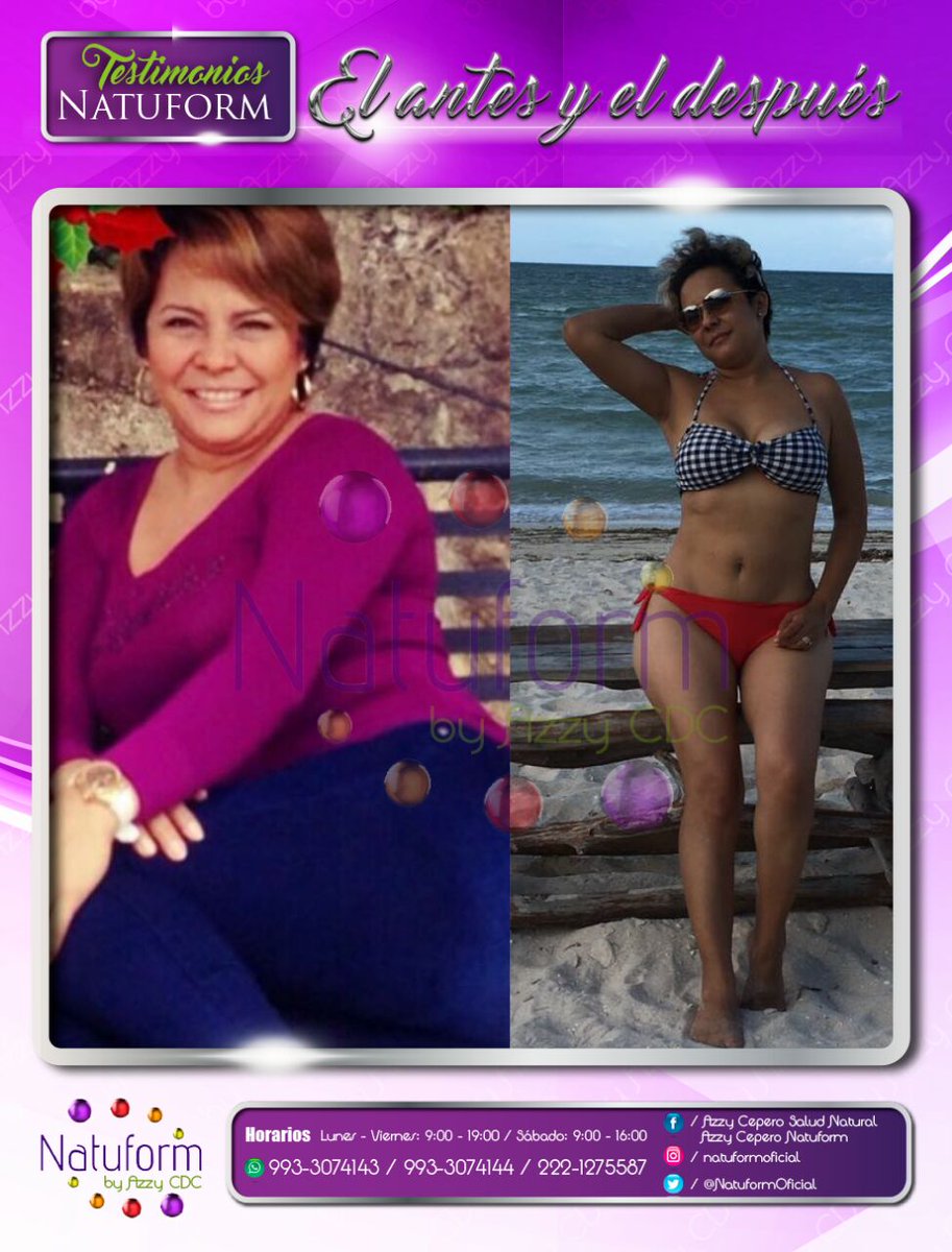 NatuformOficial's tweet photo. Y que esperas para ser uns #TestimonioNatuform https://t.co/V2lzWoW4Yj