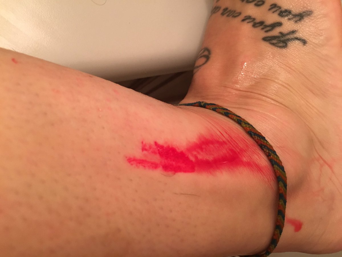 vanessa_maarie's tweet photo. 62728282 reasons NOT TO SHAVE #ItsAGash #NoExaggerating 😭🔪🏥 https://t.co/Wc2oZxfTIF