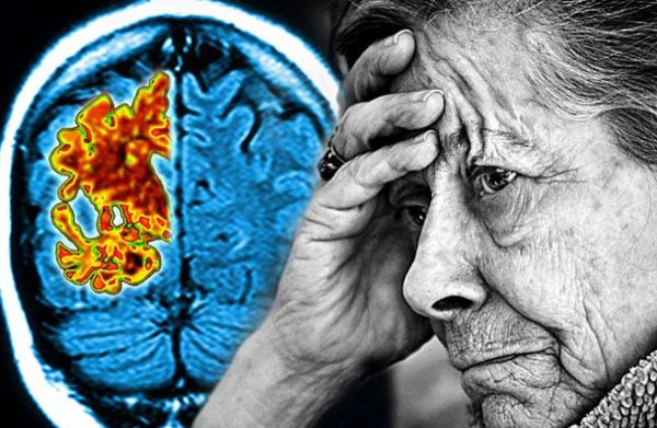 MedMarijuanaUK's tweet photo. Cannabis combating Alzheimer’s. #MedicalMarijuana
https://t.co/B2U4bcrxxH https://t.co/twnAdJEEM0