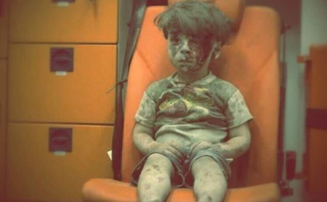 İkinci bombardımana yakalanan Ümran gözlerini hayata kapattı.............