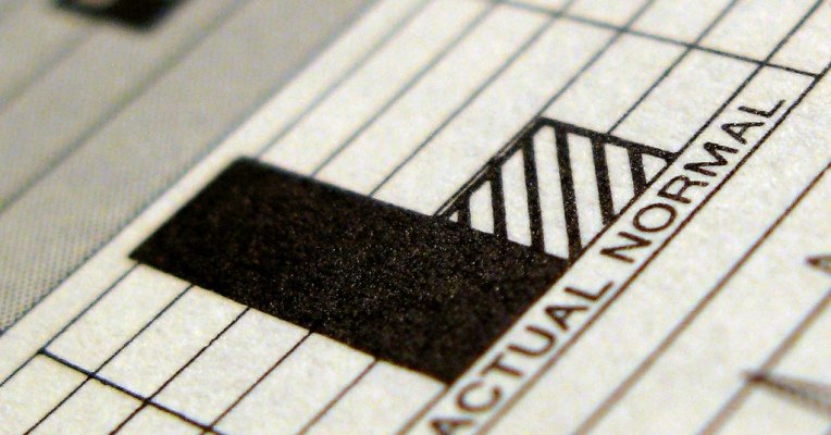 Singular, Founded By Ex-Onavo Execs, Raises $5M For Its Cross-Platform Mobile Marketing Dashboard
buff.ly/2e3WPEN