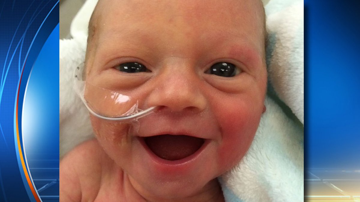 Smiling preemie photo makes the world smile bit.ly/2eOEMG8?utm_me… https://t.co/ltsnVyCx3c