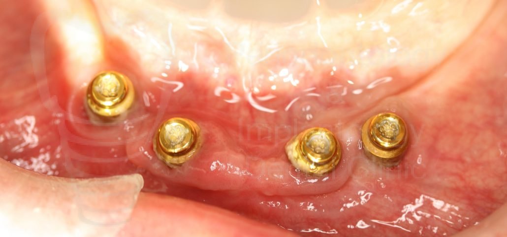 PerioImplantsGr photo