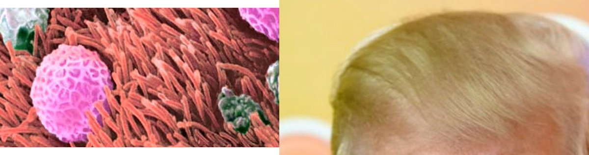 Flacilia's tweet photo. Cilia = Trump hair, which is vital to our function. Just more reasons to vote #Flacilia2016 #DeCellsion16 #Trump https://t.co/TIJJZCoysY