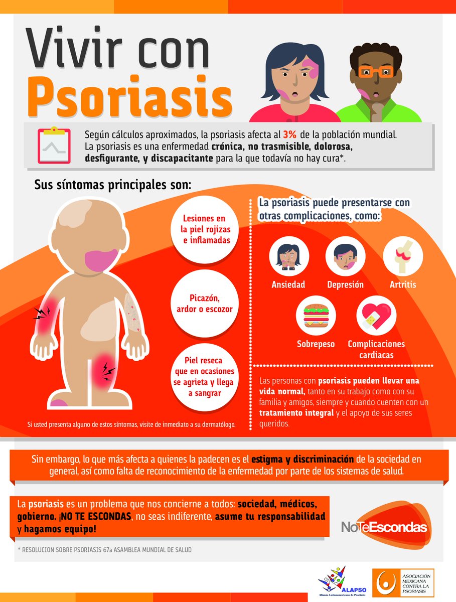 La psoriasis la clínica y el tratamiento