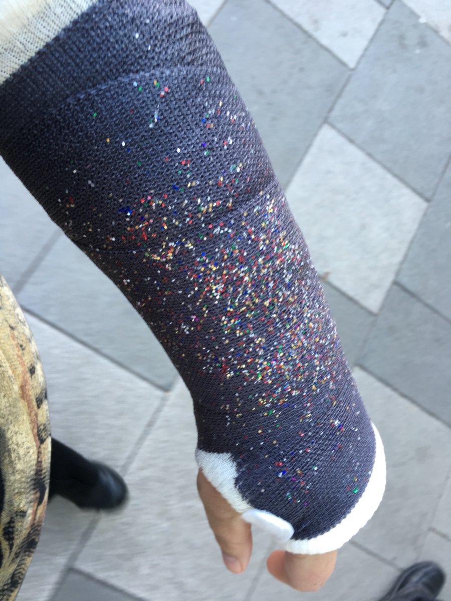 Loopylou455000's tweet photo. Mucking around, broke wrist, partner feels guilty, buys @coldplay tickets for Cardiff 2017! #hesakeeper https://t.co/6X0QQpL42U