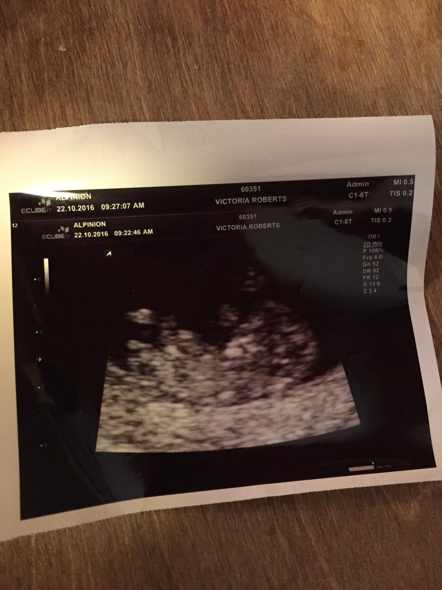 F2MMR's tweet photo. Feeling a little excited!!!! #peanut2 #lovemyfamily #lovemrsr https://t.co/d3EfN2es8N