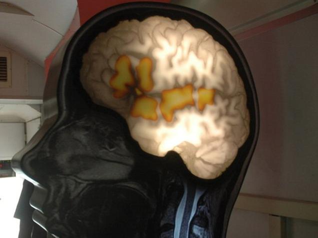 the_hindu's tweet photo. #WeekendBeing: India needs to talk about mental illness https://t.co/b3sXktfpMc https://t.co/q7lxljXvJM