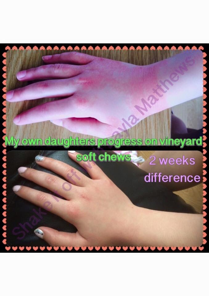 Want help with a skin condition? Desire longer hair? Need better nails? Crave more energy? I can give you all this from 2 little capsules📢