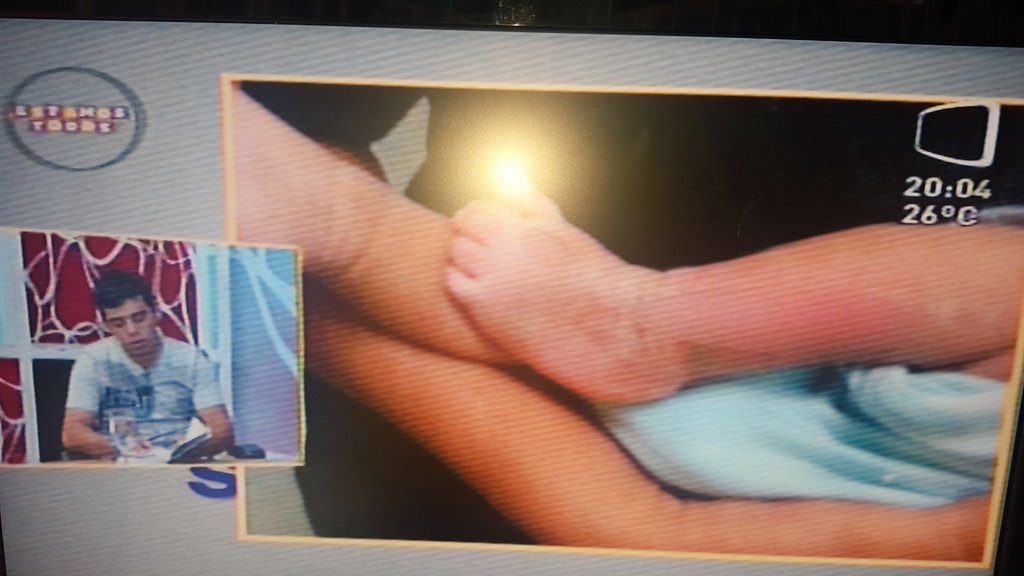 Padres denuncian #NegligenciaMedica en IPS. Un bebé tiene una cortadura con bisturí en la pierna y le dan el alta. Ahora en #7Dparaguay