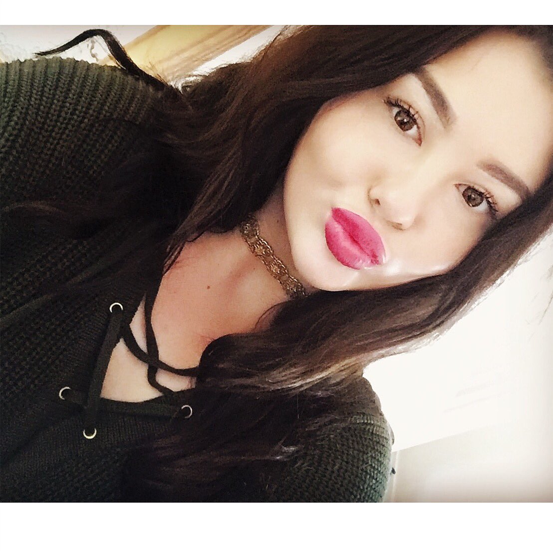 Becxa_'s tweet photo. My lips are forever getting bigger ha 💋💉 https://t.co/MHJO1byHoR