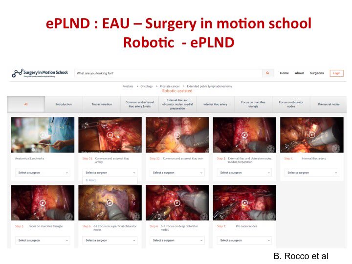 bernardorocco73's tweet photo. @Uroweb @UrowebESU surgery in motion school: ePLND videos presented in Greece at the #Esucourse https://t.co/qQcugblCfX
