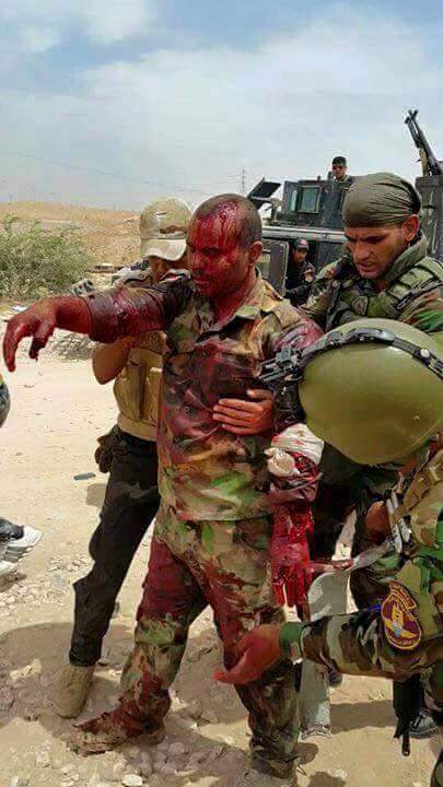 يا جرح ضمادك عافية الوطن
يا ليل لازم يطرك صبح
يا فخر الكتاب التأريخ لغيرك ما كتب
السلام على أصحاب الحسين
#دقت_اجراس_النصر