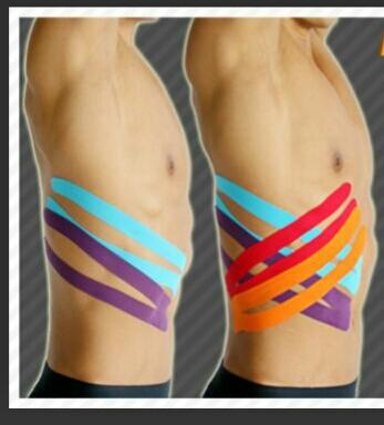 ovando_antonio's tweet photo. Aplicación de kinesiotape en lesiones deportivas. Agenda tu cita al: 961 228 75 75 https://t.co/MlO1l4kC05