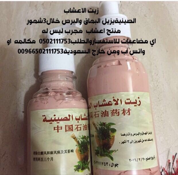 زيت الاعشاب الصينيةيزيل البهاق والبرص خلال3شهورمجرب ليس له اي مضاعفات للطلب0502111753  مكالمه  او واتس أب ومن خارج السعودية00966502111753