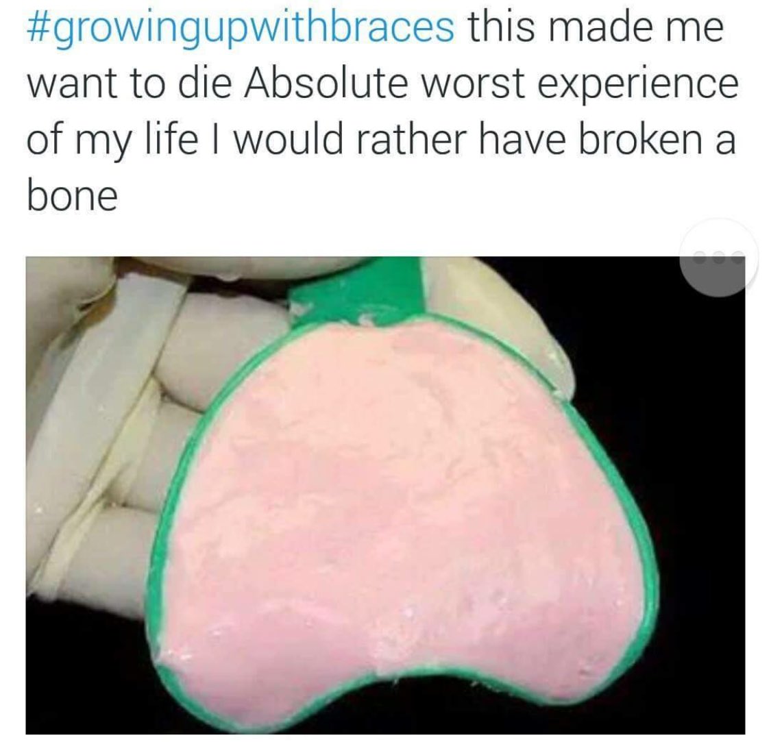 AnnieMay9386's tweet photo. This is the worst experience for me now π #havingbraces https://t.co/4KN33pwNnj