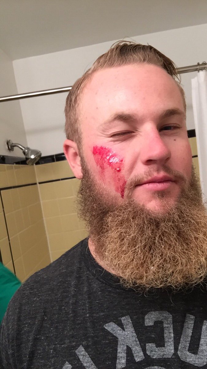TheWalkMan_'s tweet photo. I'm never doing shots again #messedupmonday https://t.co/bljBxNBxHF