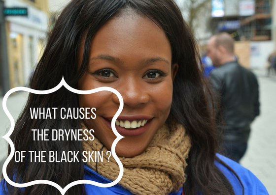 Epiderm_en's tweet image. en.blog.epiderm.co/black-skin-dry…
#blackskin #dryskin #brownskin #skincare