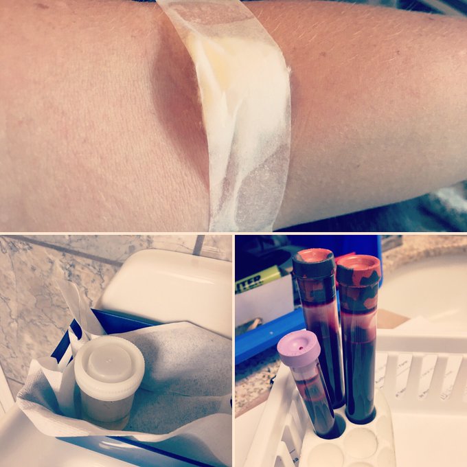 Thanks @cuttingedgetest for quick and professional STI testing! #KnowYourStatus #NoProp60 #PokeAndPee<a class="tags" target="_blank" title="On Twitter" href="/?out=eyJ0eXAiOiJKV1QiLCJhbGciOiJIUzUxMiJ9.eyJpYXQiOjE3MjE4OTE4MTgsImlzcyI6InR3cG9ybnN0YXJzLmNvbSIsIm5iZiI6MTcyMTg5MTgxOCwiZXhwIjoxNzUzNDI3ODE4LCJyZWRpcmVjdF91cmwiOiJodHRwczovL3R3aXR0ZXIuY29tL2N1dHRpbmdlZGdldGVzdCJ9.Q4DJhAmzt1IXwqH2ANxw1T7cY4Ej4UmeEBd0pov6mMSYJUDpLIRhOrkHDGpSo6wYMTK8nruVEomWnjRICm_lSw">@cuttingedgetest</a><a href="/tag/knowyourstatus"class="tags"><span>#knowyourstatus</span></a><a href="/tag/pffberlin"class="tags"><span>#pffberlin</span></a><a href="/tag/noprop60"class="tags"><span>#noprop60</span></a><a href="/tag/pokeand"class="tags"><span>#pokeand</span></a>