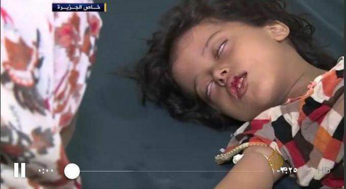 عدن : من لم يمت با الحرب  

اليوم يموت بسبب الكوليرا "

#شكرا #هادي