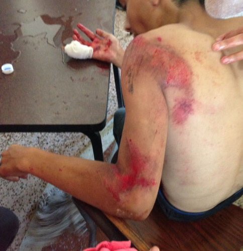 VandarX1's tweet photo. This how Maduro's regime represses and violates the human rights of Venezuelan young students #SOSVenezuela @marcorubio @RosLehtinen https://t.co/03C3LRHZUy
