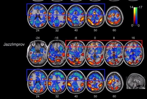 openculture's tweet photo. This is Your Brain on Jazz Improvisation: The Neuroscience of Creativity https://t.co/cp1B9h6s0m https://t.co/kJdXuXDuhT