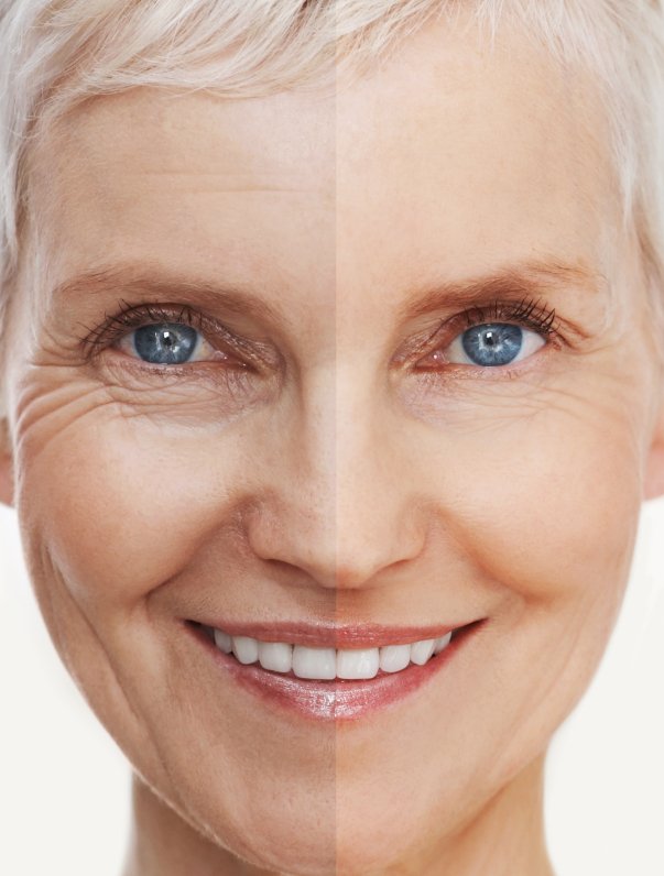 SkinMedicalUK's tweet photo. NEW BLOG ALERT: Prescription or Over-the-Counter Retinols: 
https://t.co/VQOJ1g2xwc https://t.co/TmsiSvGX25