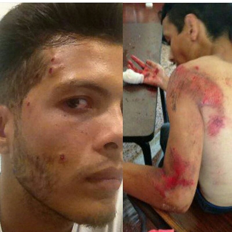 OliverLopezCano's tweet photo. Así es el dialogo que pregona el regimén, con ataques a punta de ploma a estudiantes. ¡No hay Dialogo con matones! Van pa' fuera y punto!!. https://t.co/JrJOdMys60