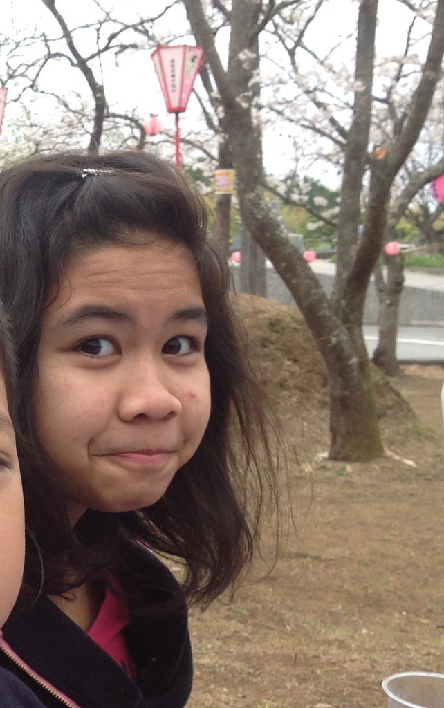 chemkameh's tweet photo. 13 year old me w/ freckles. That pimple tho. 😂😂 #throwbaaaack https://t.co/RvsGiJMwg6