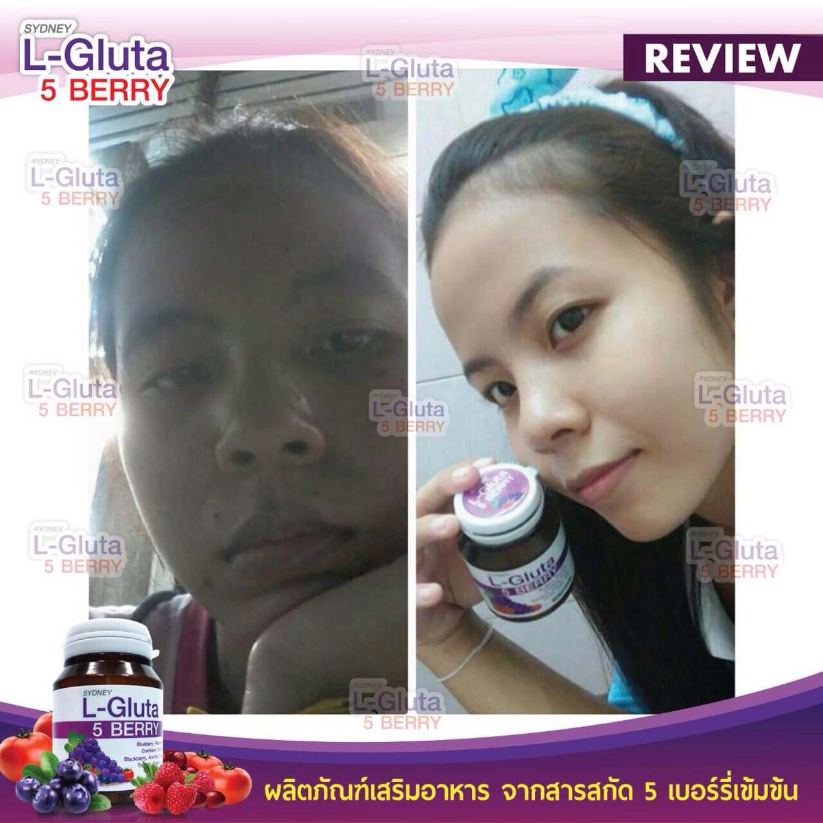 lovelyshopone's tweet photo. อยากผิวสวยต้องลอง 🍒🍓🍇🍅#gluta #5berry #howtoperfact #sydney #glutasydney https://t.co/rbma6HGIgz