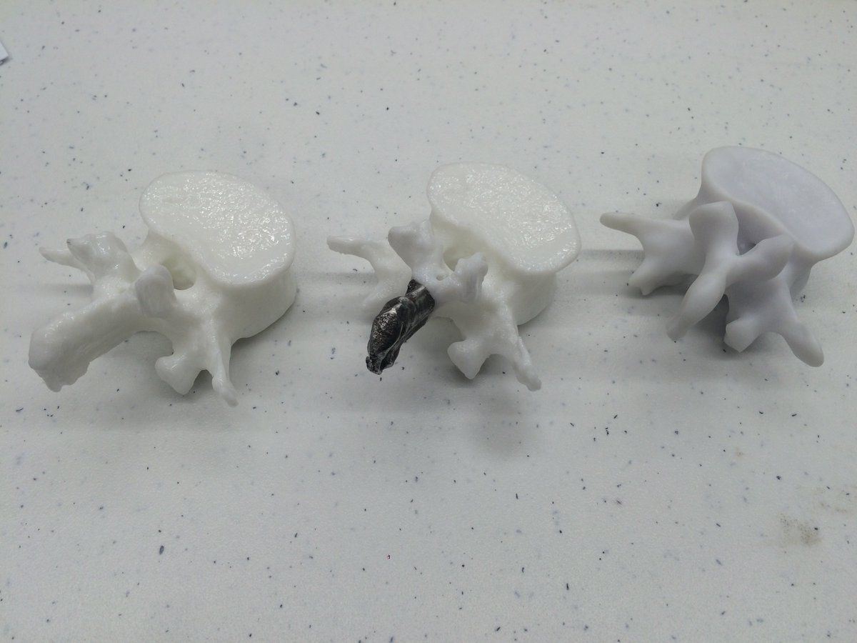 Mq_SoMaPS's tweet photo. #PHTN310 Madeline's work 3D printing Prosthesis with plastic and metal printers.
https://t.co/J2QlDOyL9w #mqpace https://t.co/d8UaTpH748