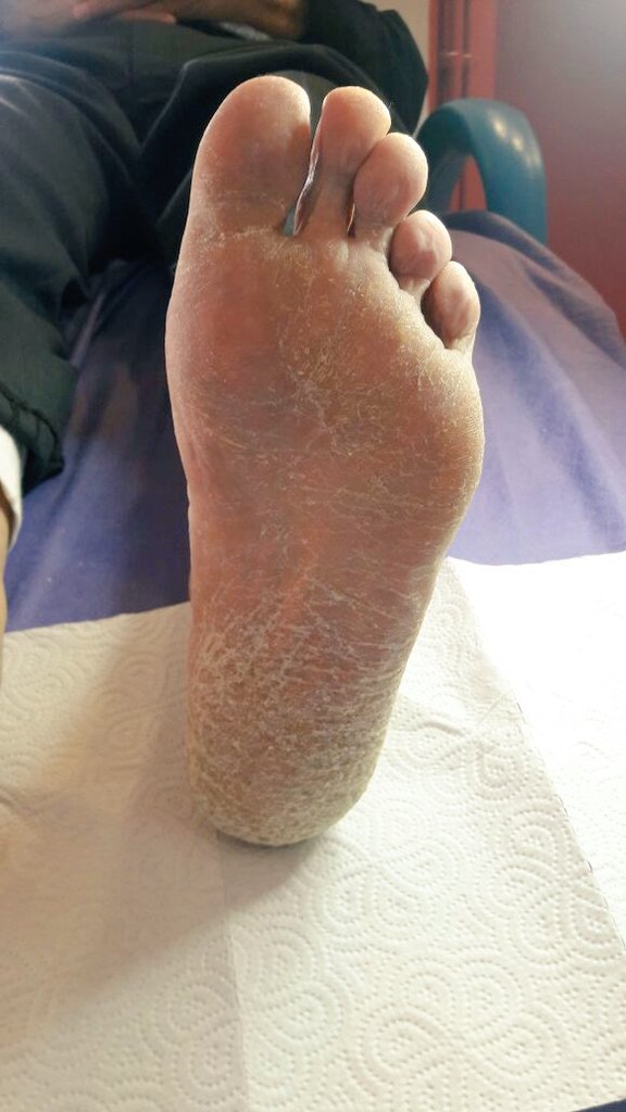 Bugün gelen hastamızın işlem öncesi durumu.