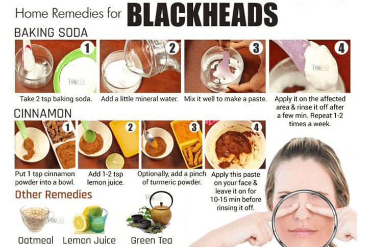 studiofpk's tweet photo. Home Remedies for #Blackhead @SimpleSkincare @AcneSkinSite #SkinCare #BlackHeadsRemovel #SkinFresh #SkinGlow
Detail:https://t.co/xTWaFAUkx0 https://t.co/41UkWgQ8qR