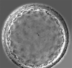 rrbehringer's tweet image. The #marsupial blastocyst does not form an inner cell mass!