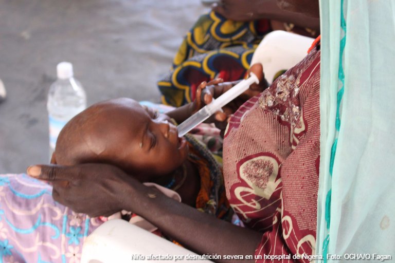 ONU_es's tweet image. Las Naciones Unidas alertan de que Nigeria se enfrenta a la peor crisis humanitaria de #África bit.ly/2dXJHSr