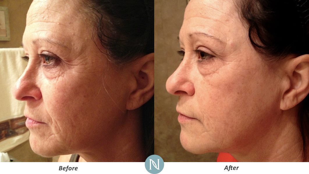bewell3_'s tweet photo. Time to turn back time w NeriumAD night cream. Risk-free 30day guarantee➡️https://t.co/2nqTuYCEA5 #antiaging #skincareroutine #skincaretips https://t.co/65aokDhZlm