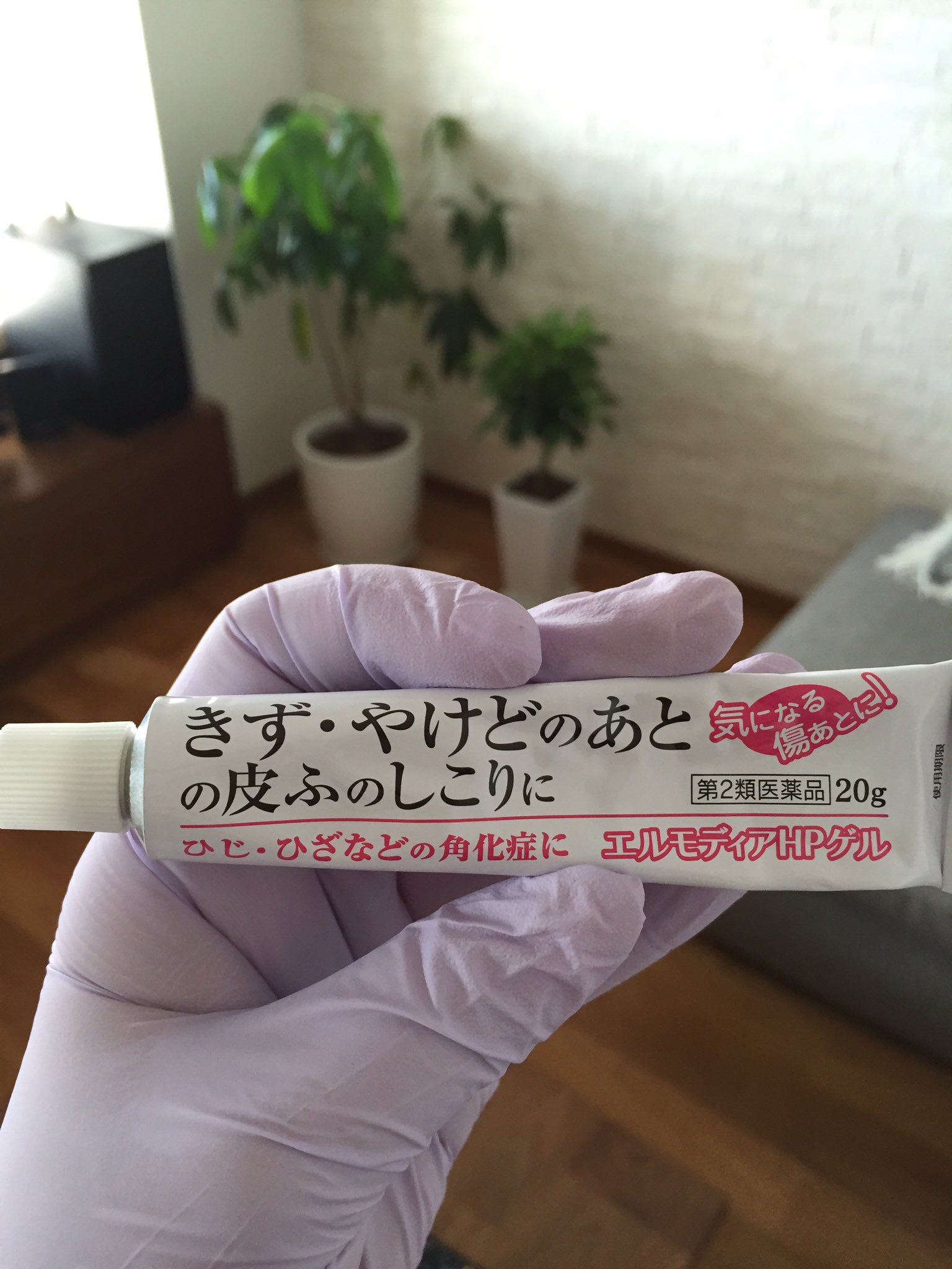 Kinatan Di Twitter 夫に火傷の傷がグロいから見たくないと言われ薬塗ったあとにゴム手袋してます O でも 色がちょっと 変わってるだけで言うほど酷くはありません 火傷の傷が治ったら虫刺されの痕を消したくて買ったアットノンもどきを試してみようかな