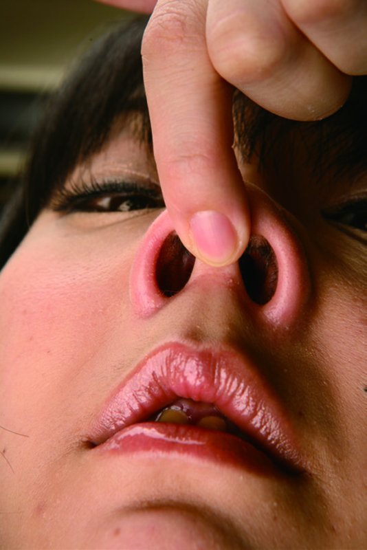 熟女の鼻フック 