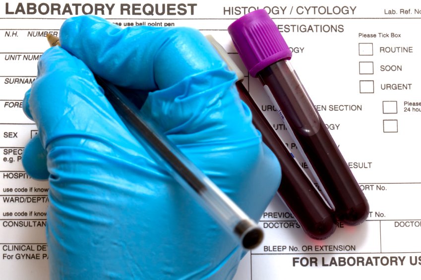 Should I be worried about blood test results that fall out of the normal range? ow.ly/sAt8305ABx4 #AskDrK