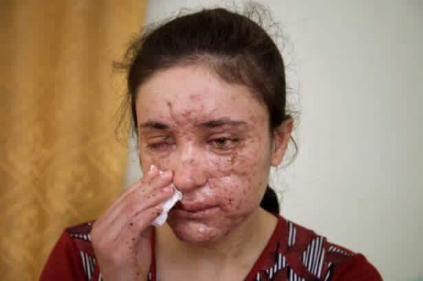 Alshingaly123's tweet photo. عاجل... الضحايا الايزيديات، بإسمهم نادية مراد ولمياء حجّي بشار) يحصلون على جائزة زاخاروف https://t.co/BrtIBA9JxD