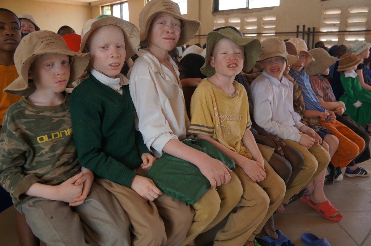 UNHumanRights's tweet photo. Albinism: “Cost cannot be an excuse when fighting violence &amp; discrimination” – New report by @UnAlbinism https://t.co/q7Ii0LOgp1 #NotGhosts https://t.co/n425SaAuyz