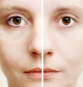 epiphanyfrisco's tweet photo. 3 Myths About Acne Scars that Deserve to be Debunked https://t.co/ErCGCHGCJx https://t.co/IekBwtUygv