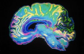 RateTheMix's tweet image. The #Brain and what its got to do with it goo.gl/GEumli @proaudiofiles