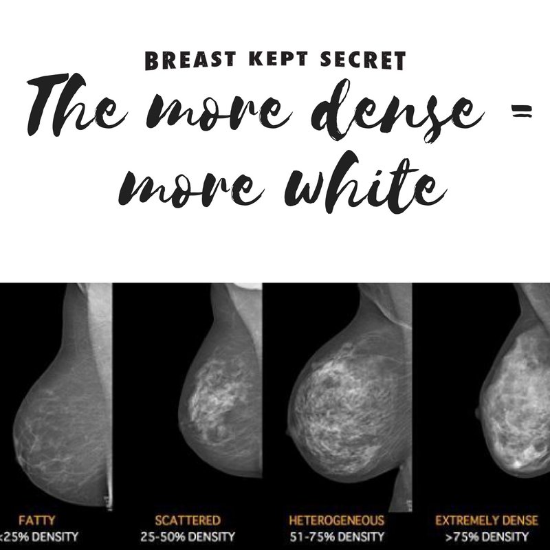 BreastKeptScrt's tweet photo. Did you know? If you have dense breasts it can make it harder to spot cancer on a mammogram. Find out more at https://t.co/PmGDF9I6hW https://t.co/NdyKd3aFGz