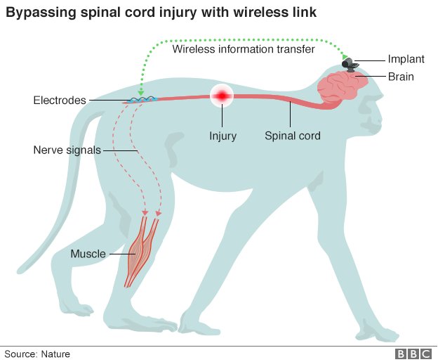 BBCNews's tweet image. "Brain wi-fi" has been used to restore movement in paralysed primates
bbc.in/2fFeLEy
