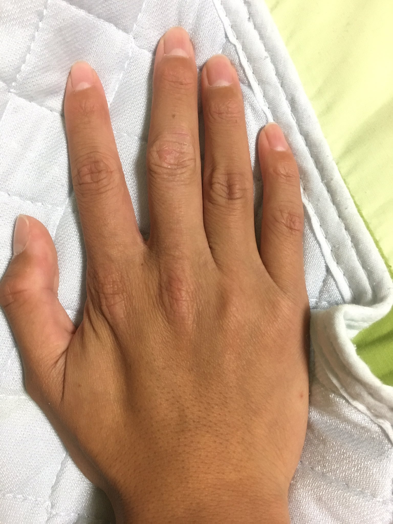 ガバっしい 友達に 体毛が薄くて温泉行くの恥ずいんだけど Q って最近の悩みを相談してみたら 16歳5ヶ月ですね毛や脇毛がほとんど生えない 男性ホルモンが少なくて女性ホルモンが多いんじゃね とかいう答えが返ってきた 僕の指は女性ホルモンが