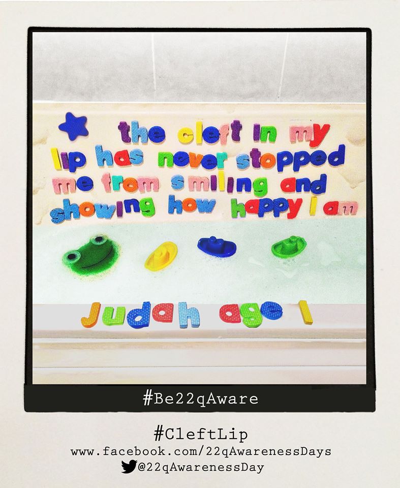 22qAwarenessDay's tweet photo. Judah had a complete cleft lip & palate
He died from pneumonia as a result #22q #ImmuneIssues last year
He was just a year old #Be22qAware https://t.co/aNksBtOeij