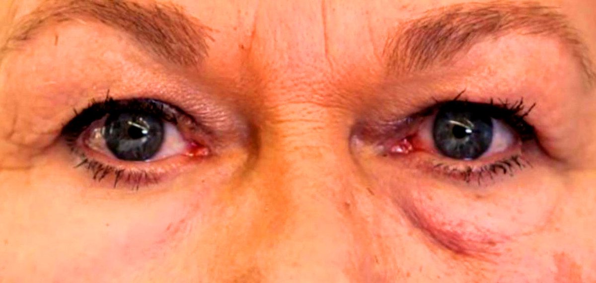 Quella tecno-crema #antirughe nata da uno spin off del MIT chefuturo.it/2016/11/crema-…