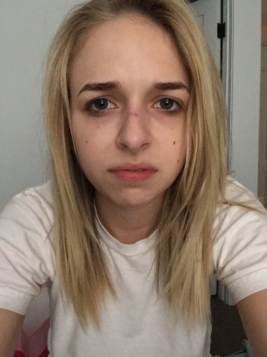 Jenn McAllister on Twitter "I put a "Breathe Right" strip on my nose